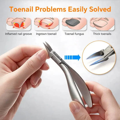 🦶 Limited-time 40% Off! ⚡ Stainless Steel Ingrown Toenail Clipper Set – Precise, Sturdy, Portable ✨